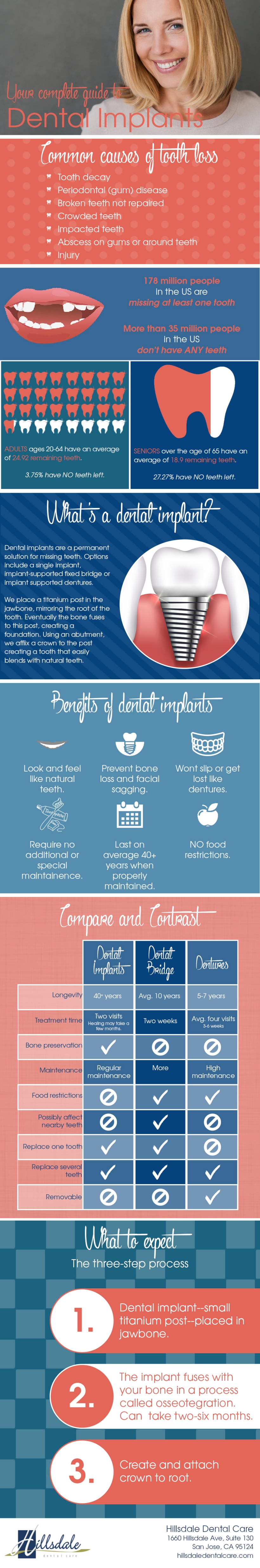 Complete Guide to Dental Implants INFOGRAPHIC